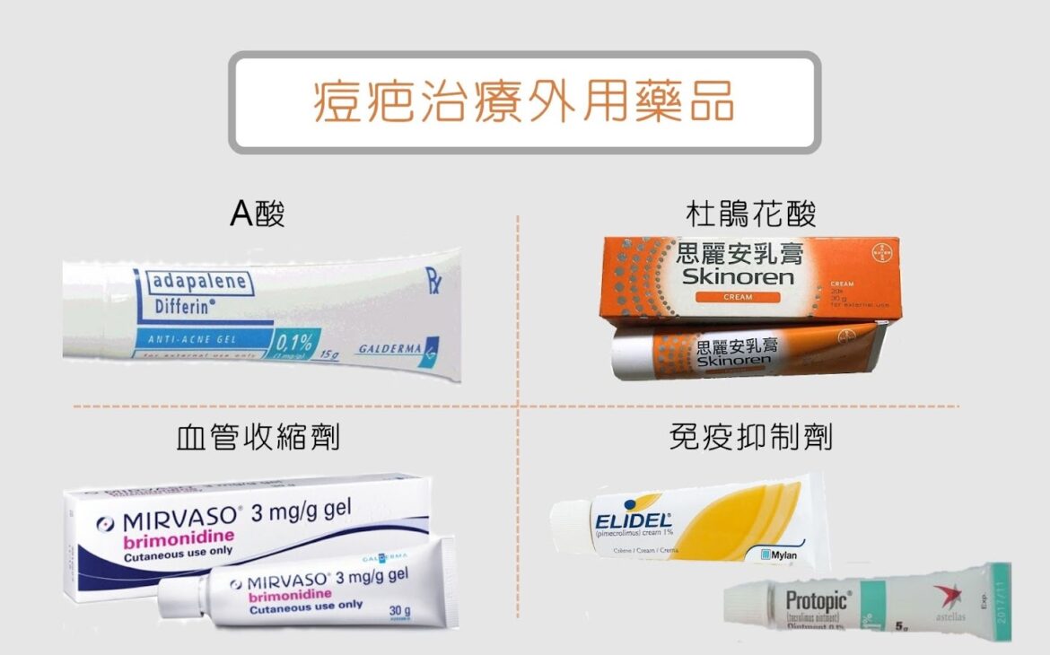 如何選擇針對痘印的護膚產品？皮膚科醫生完整教學，高效淡化痘印秘訣！