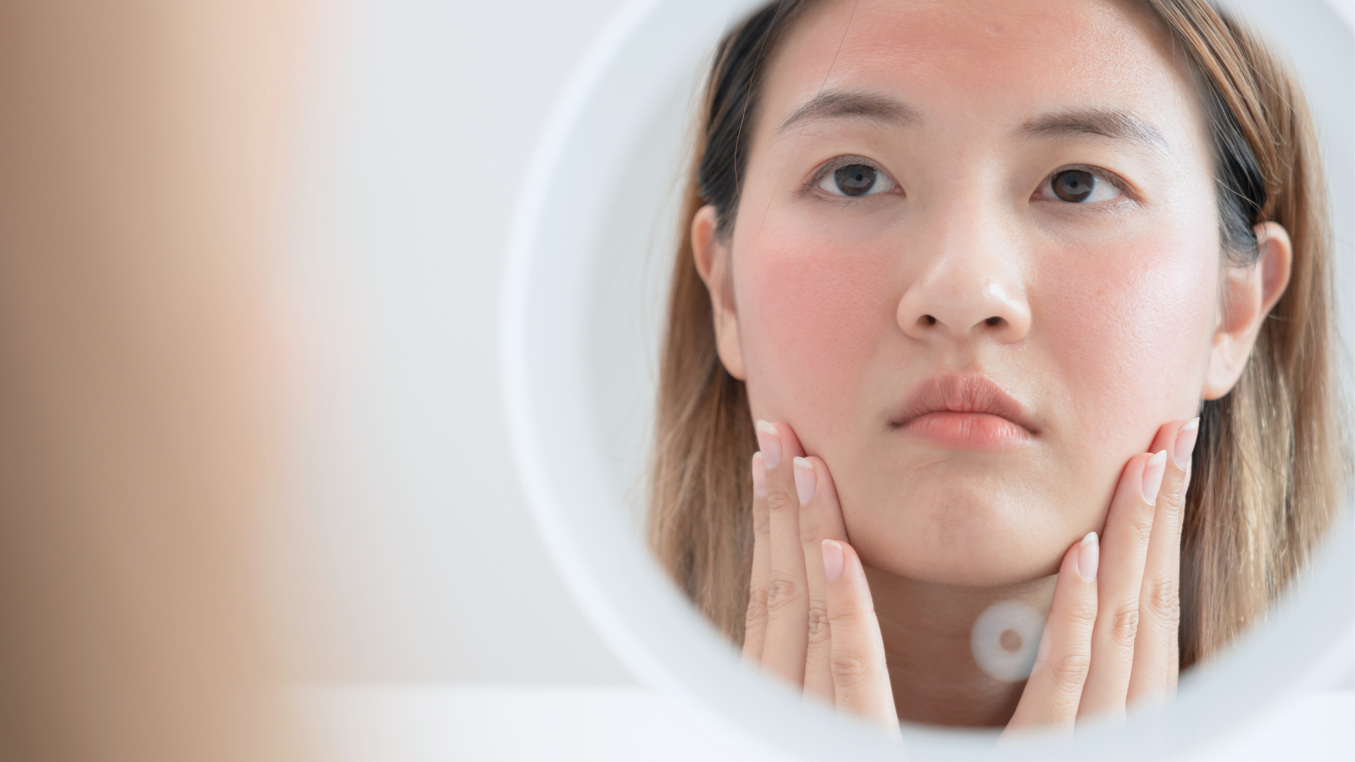 臉頰泛紅會自己好嗎？還是要特別保養？關鍵護理全攻略！