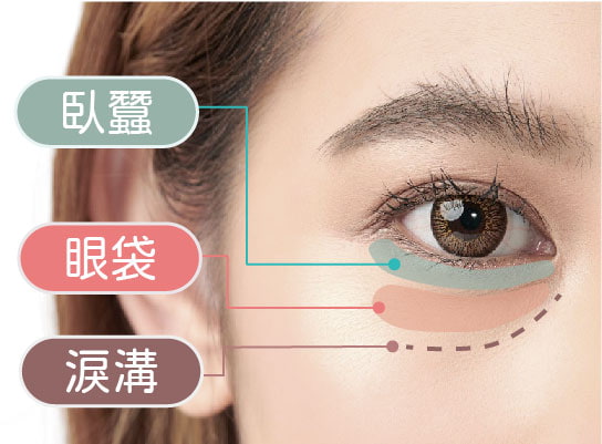 如何有效改善眼袋問題？十年皮膚科醫生教你重拾明亮眼眸的完整教學