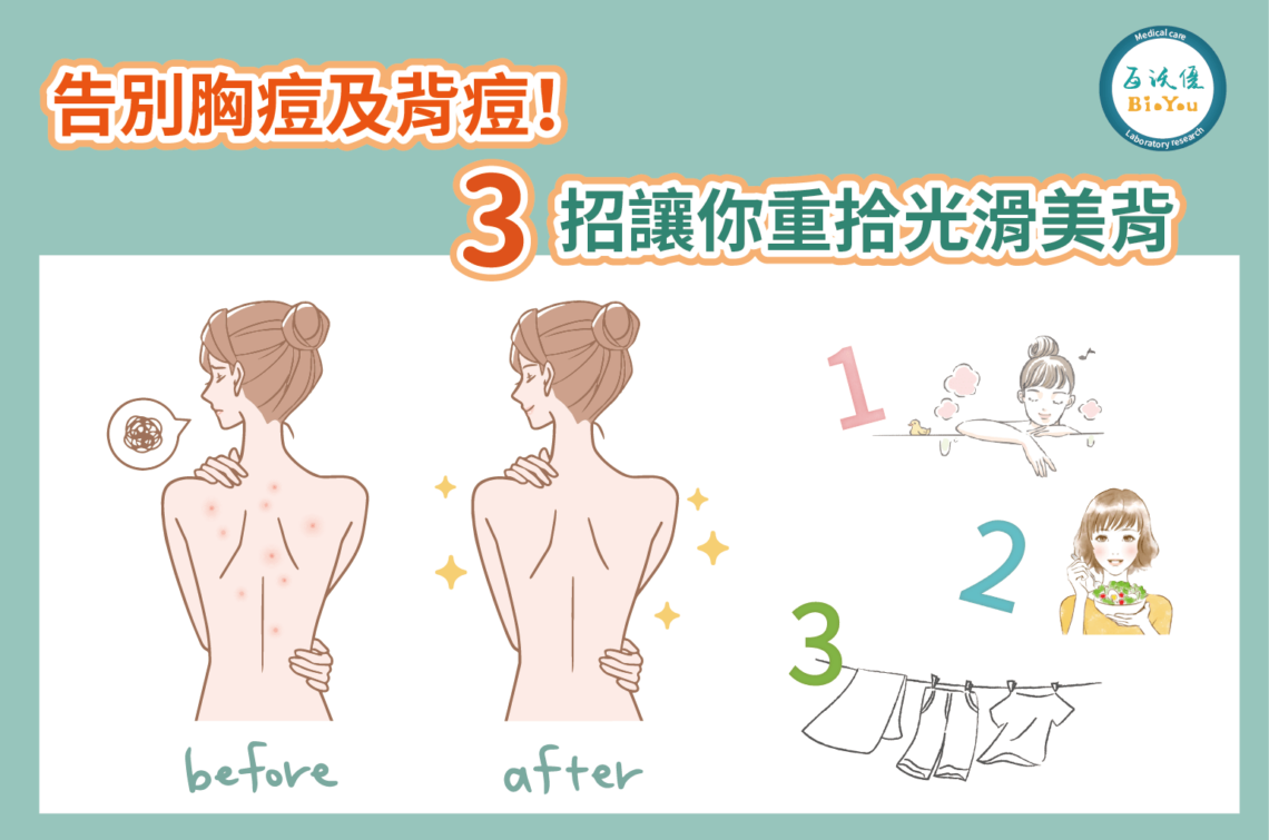 夏日背部防曬與背痘護理法：告別痘痘，擁有自信美背！
夏日美背秘笈：防曬+護理，擺脫背痘困擾！