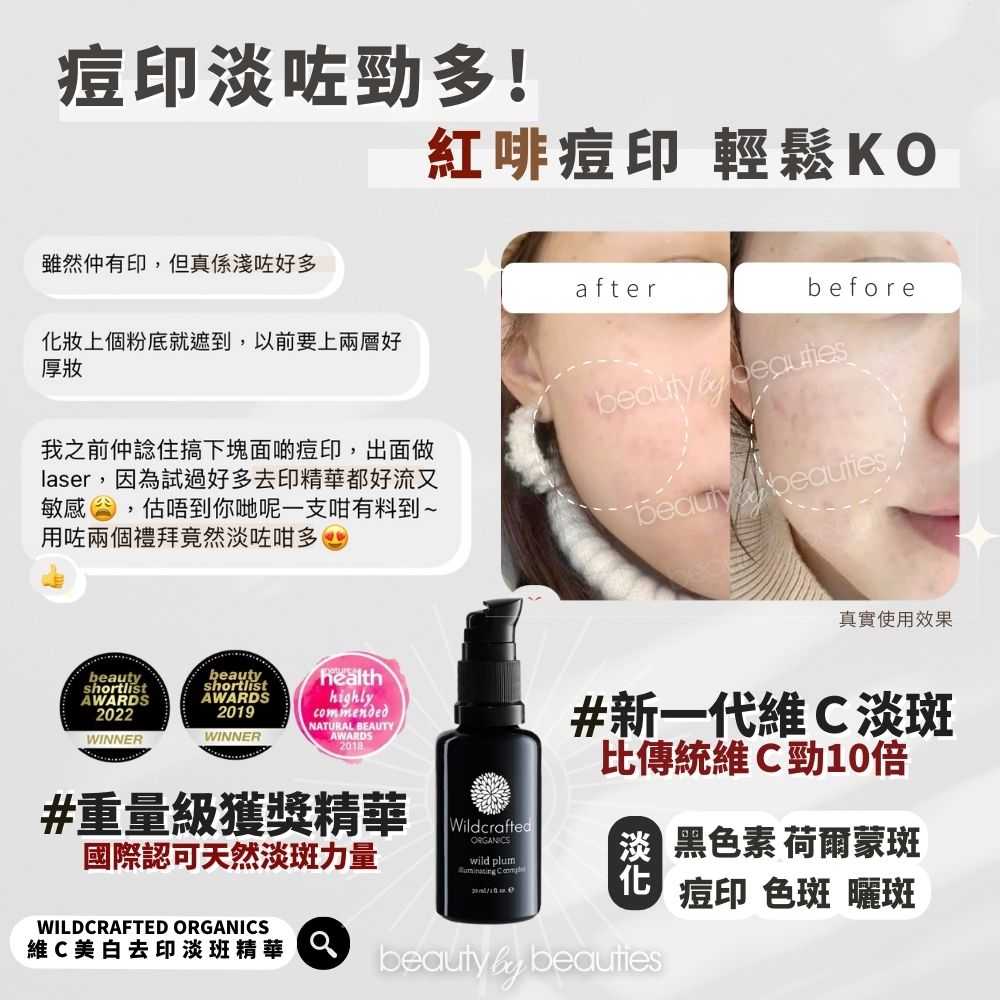 減少痘印的護膚方法：高效淡印攻略，維C、煙酰胺、A醇必學指南