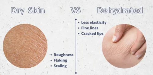 脱水肌と乾燥肌の違いとは？ 乾燥肌・脱水肌のタイプ別保湿ケア完全ガイド