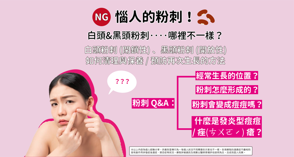 如何有效改善閉鎖性粉刺？皮膚科醫生十年經驗完整教學