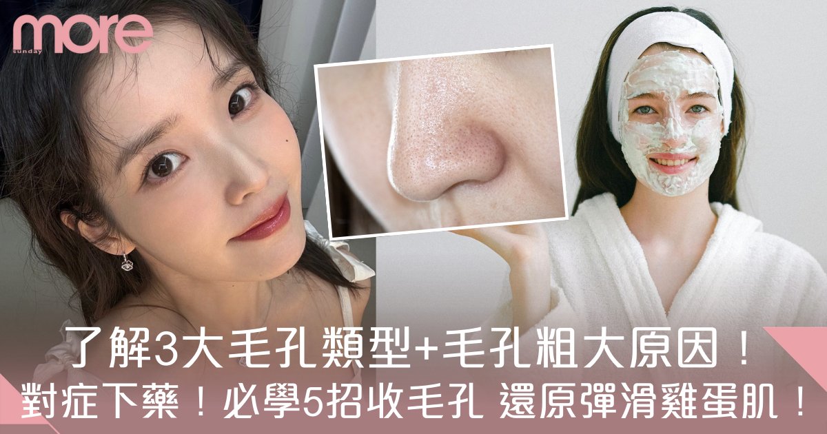 毛孔粗大要怎麼改善才有效？三大類型全攻略：油脂、老化、乾燥，必學改善對策！
