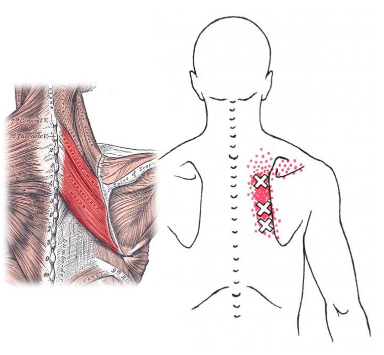 姿勢矯正專家教你核心訓練，告別駝背圓肩