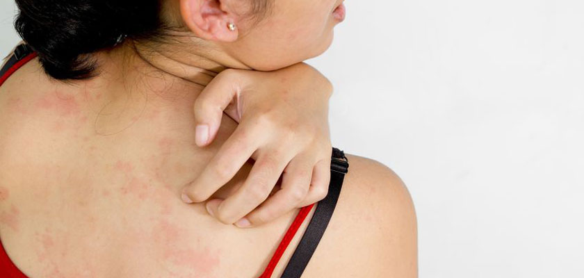 游泳池水質對皮膚影響全指南：小心游泳池的化學成分！