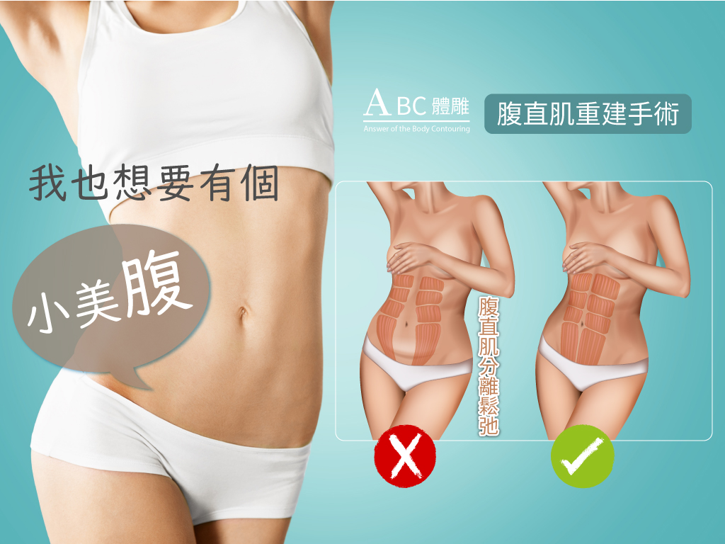 受傷後增肌的循環訓練攻略：Is Circuit Training Suitable for Post-Injury Muscle Building?