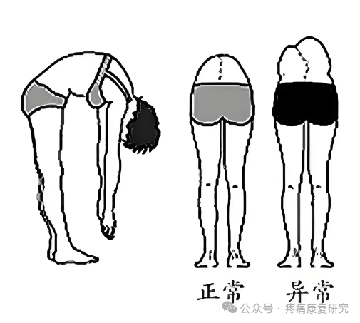 使用划船機恢復背部肌肉的好處：高效背部康復指南與技巧