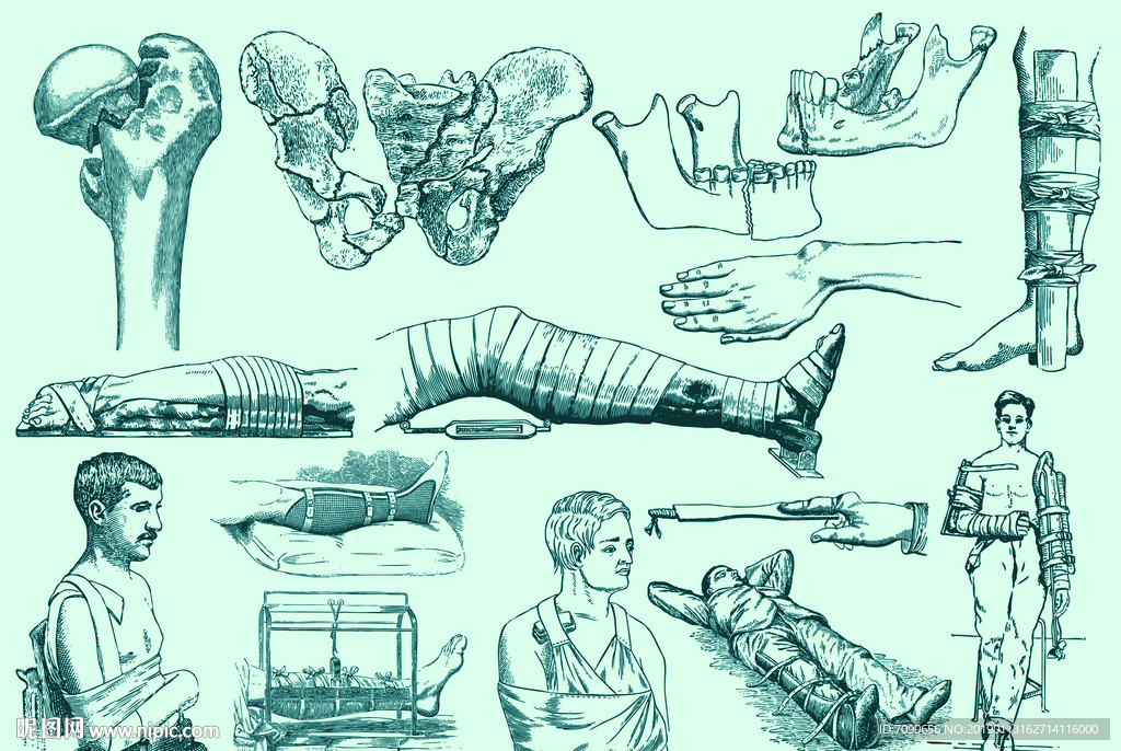 如何設計腿部恢復的阻力訓練計劃：高效重建腿部力量，完整教學！