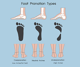 如何精選最合適的跑鞋，避開受傷風險